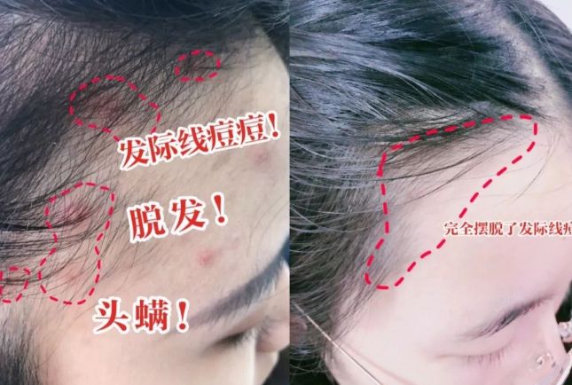 干好？10分钟轻松养成女明星「绸缎发」不朽情缘mg网址洗完头自然风干还是吹(图6)